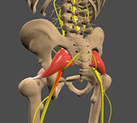 Sciatica